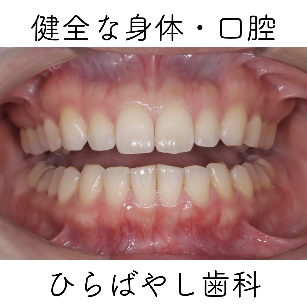 健全な口腔