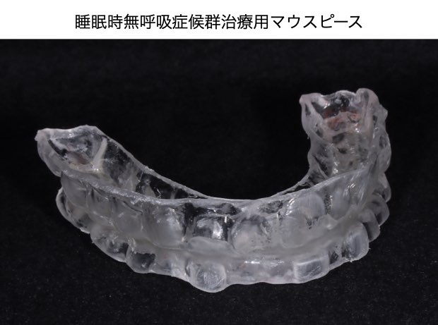 マウスピース